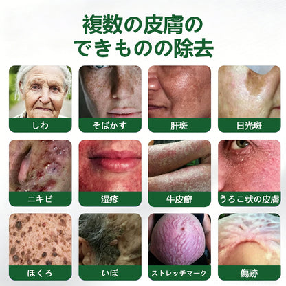 COLTURE® sim イボ・ほくろ除去マイクロニードルパッチ