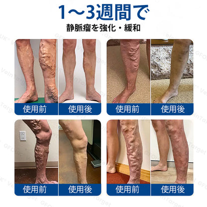 COLTURE® VeinTarget マイクロニードルパッチ⚡即効性、長期的な効果