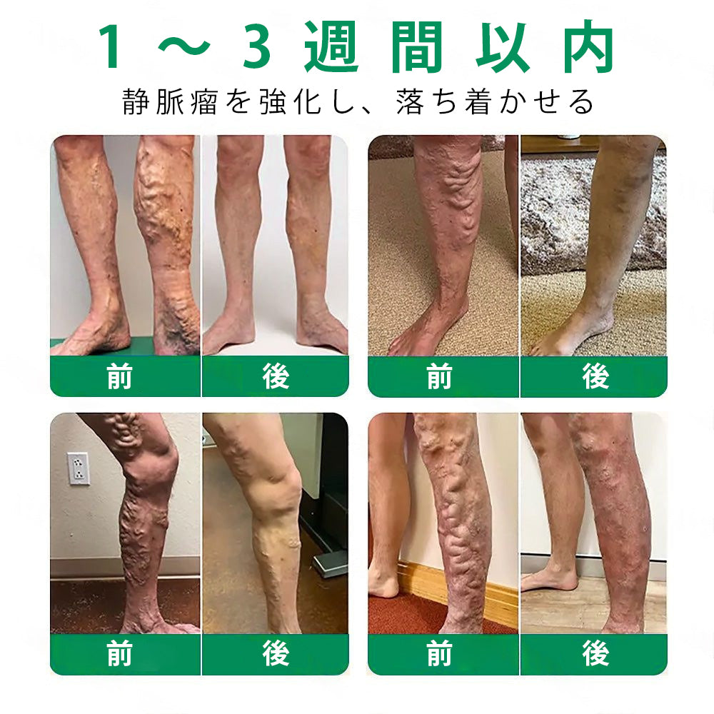 Slim Latte® VeinTarget アルプスハーブ配合 マイクロニードル静脈ケアパッチ 💚💚
