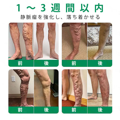 Slim Latte® VeinTarget アルプスハーブ配合 マイクロニードル静脈ケアパッチ 💚💚