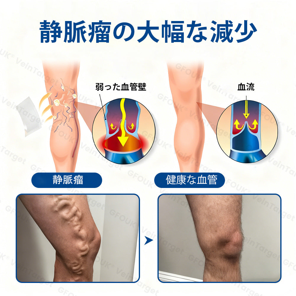 COLTURE® VeinTarget マイクロニードルパッチ⚡即効性、長期的な効果