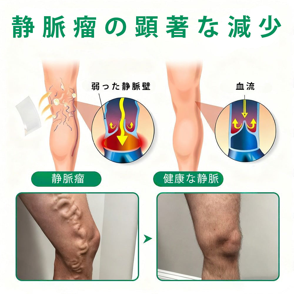 Slim Latte® VeinTarget アルプスハーブ配合 マイクロニードル静脈ケアパッチ 💚💚