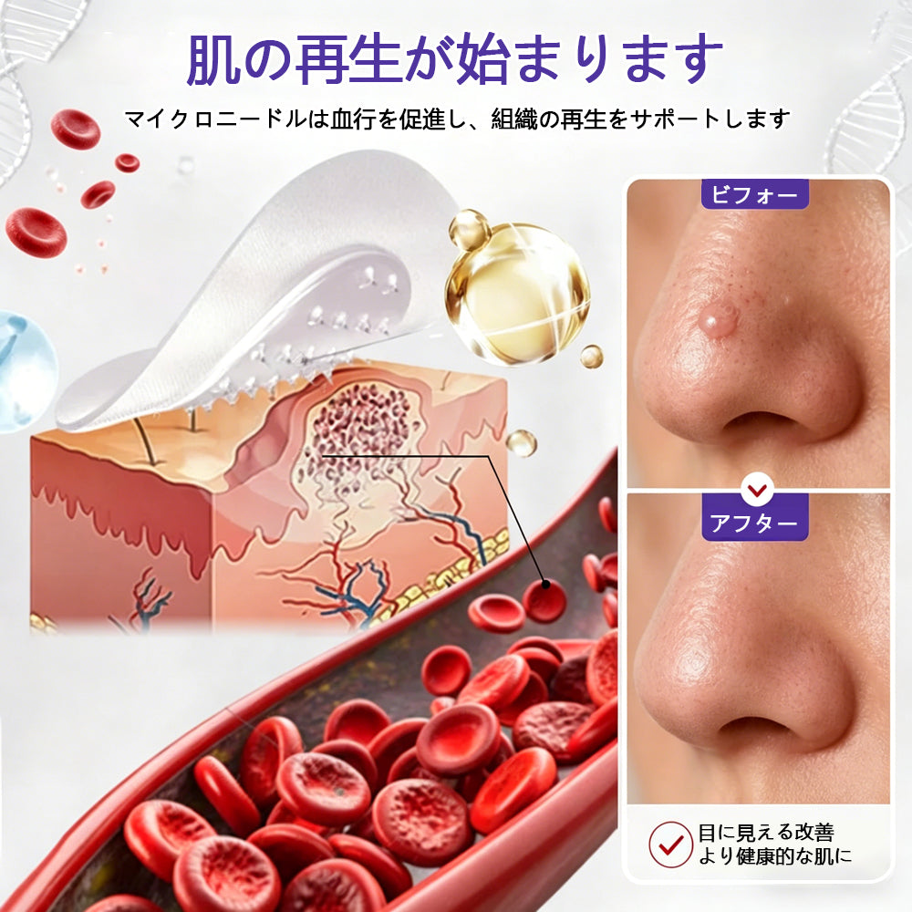 COLTURE® イボ・ほくろ除去マイクロニードルパッチ✨