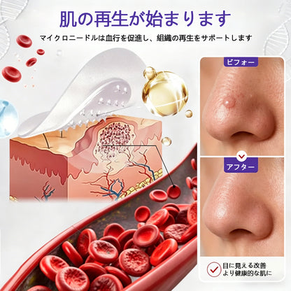 COLTURE® イボ・ほくろ除去マイクロニードルパッチ✨