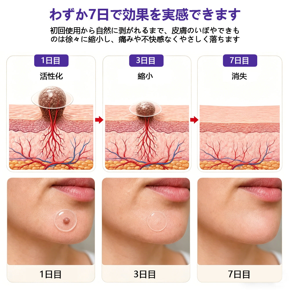 COLTURE® イボ・ほくろ除去マイクロニードルパッチ✨