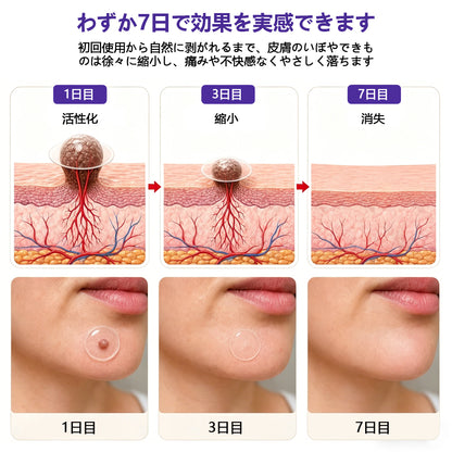 COLTURE® イボ・ほくろ除去マイクロニードルパッチ✨